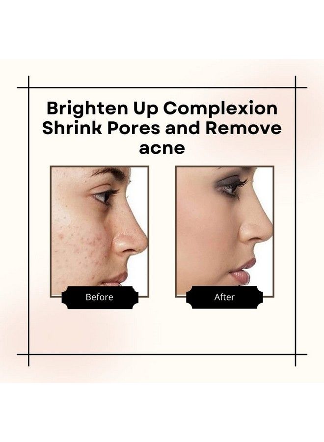 20% Vitamin C Serum & Vitamin E Oil For Face Whitening Pigmentation Radiant Skin Body Nail Dry Skin (30 Ml Each)