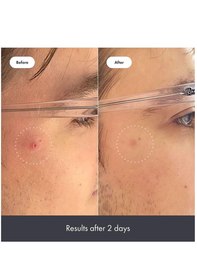 Hero Cosmetics Rescue Balm, Post Blemish Recovery Cream 15 ml
