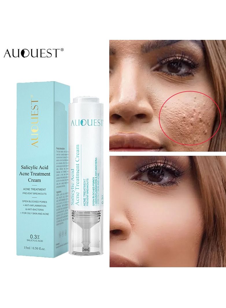 Salicylic Acid Acne Face Cream Whitening Facial Treatment Hyaluronic Acid Black Dots Remove Skin Care Beauty Health