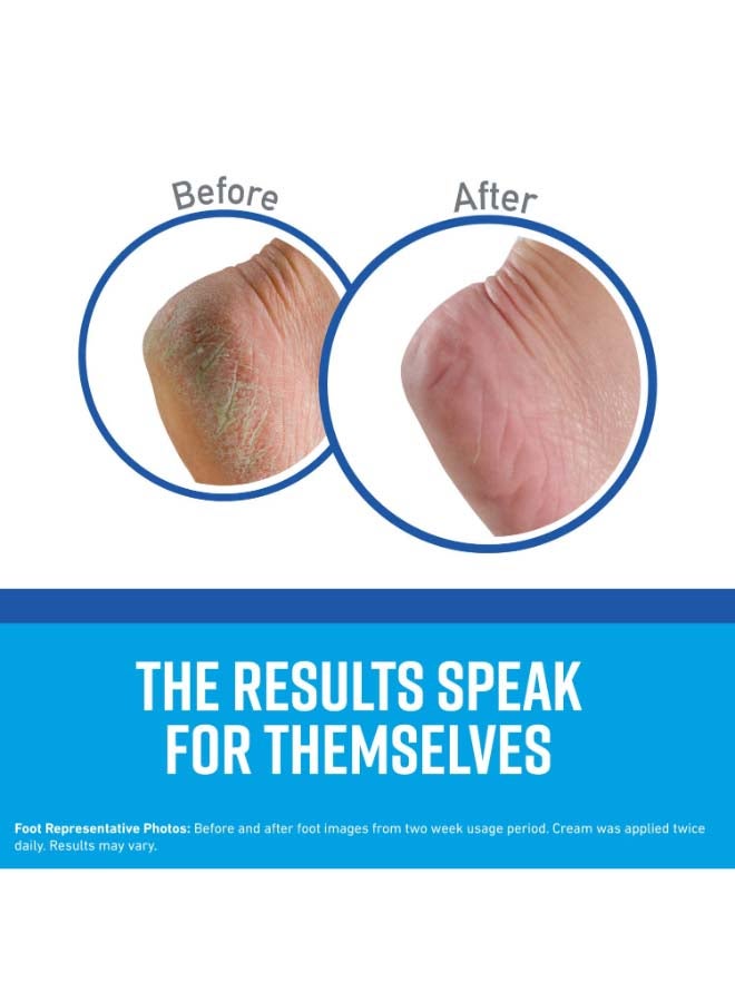 Exfoliating Moisturizing Foot Cream For Extremely Dry Cracked Feet 3 Oz (85 g) Multicolour 85grams