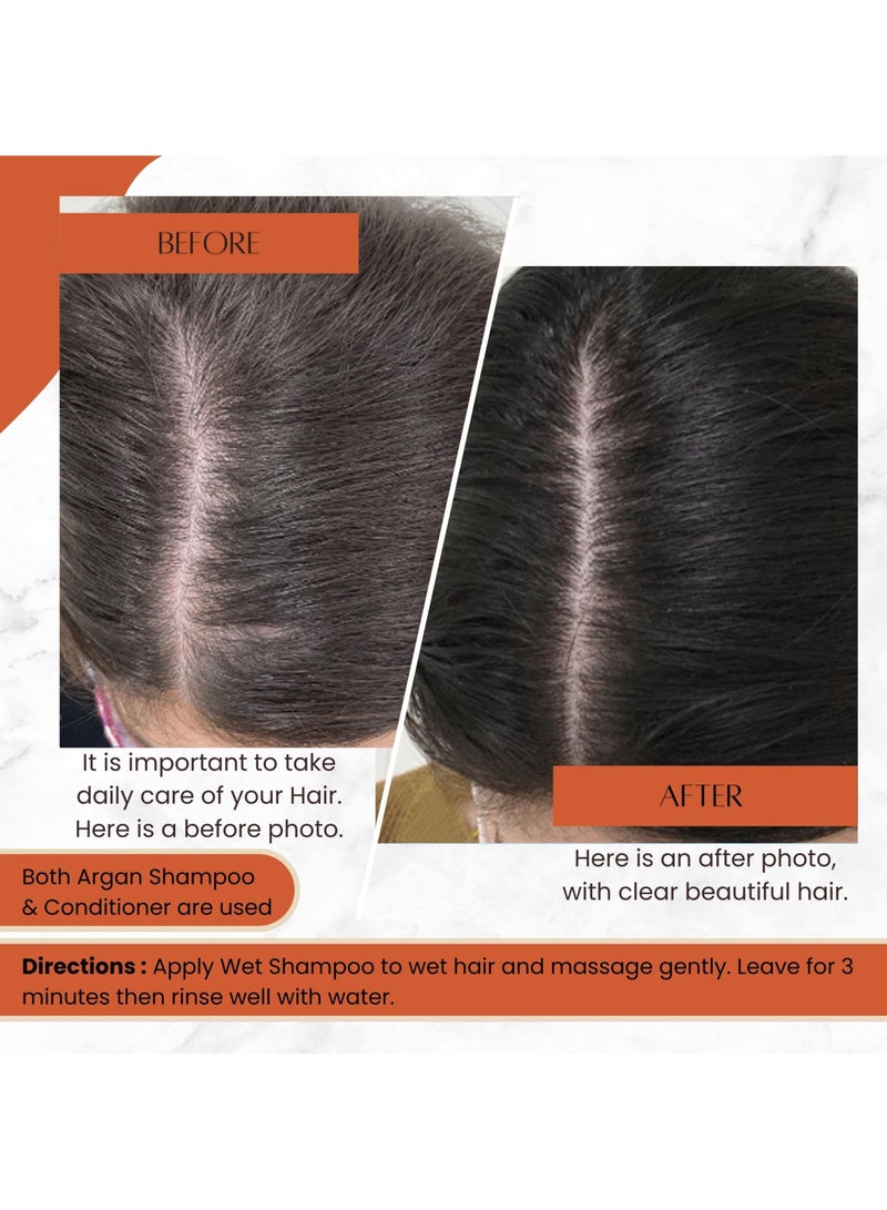 Moroccan Argan Oil Shampoo & Conditioner Pack - Ultra Hydrating - Repairs and Protects Dry Hair - Improves Hair Health - Soften & Strengthen Hair for Damaged, Dry Frizzy and Hair Loss (1000 ml)