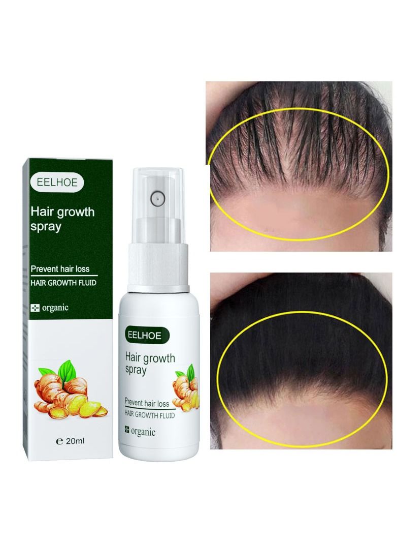 Fast Hair Growth Spray Serum Ginger Anti Hair Loss Treatment Product Prevent Thinning Dry Frizzy Repair Beauty Hair Care Essence