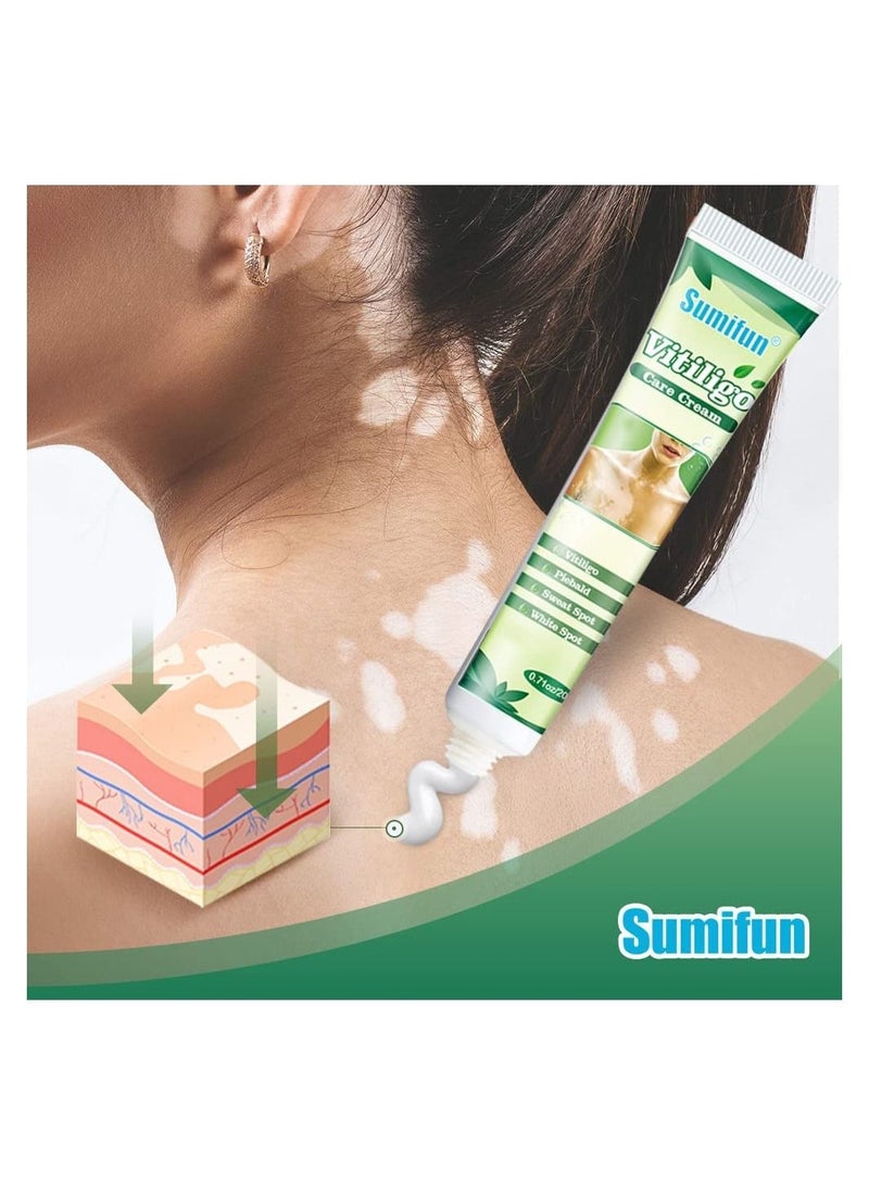 Vitiligo Care Cream Reduces White Spots on Skin Pigmentation regulating Improve Skin Pigmentation 8 Count