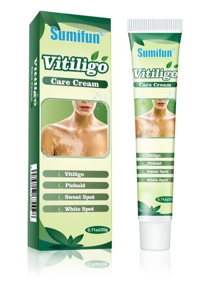Vitiligo Care Cream Reduces White Spots on Skin Pigmentation Regulating Improve Skin Pigmentation 6 Count