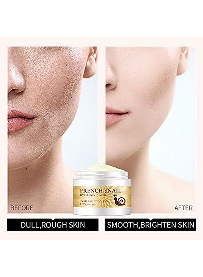 Snail Essence Face Cream Moisturizing Acne Scar Removal Cream Improve Skin Nourishing Collagen Essence Cream For Improve Damaged Skin