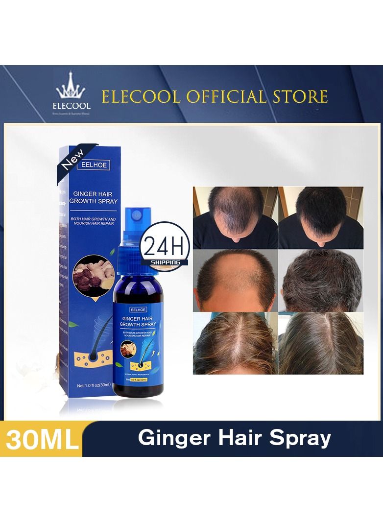 Ginger Hair Grower spray Anti Hair Fall Hair Loss Treatment Hair Growth Essence Oil for Men Women