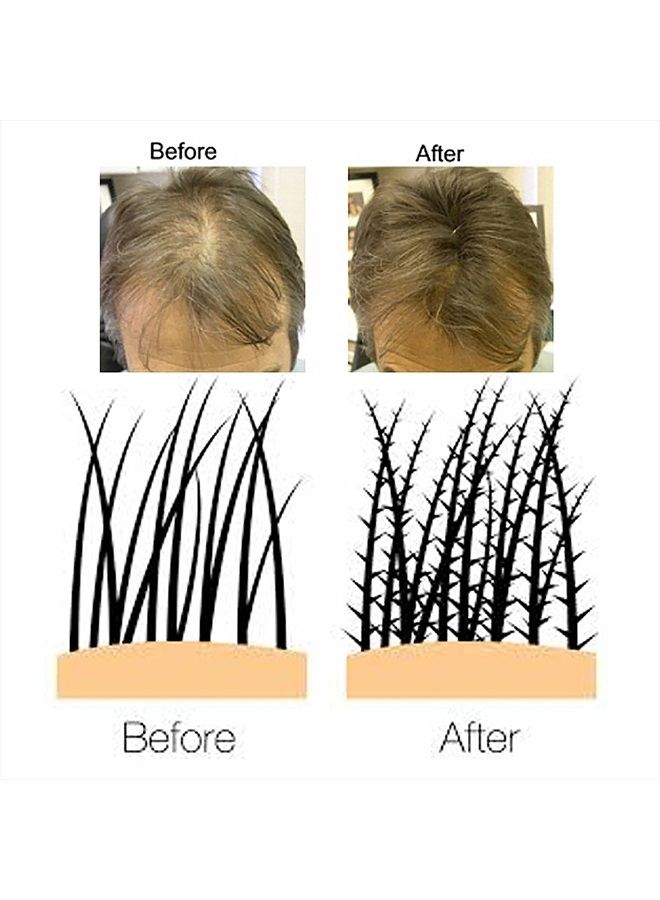 Professional Hair Building Fibres- Hair Loss Concealer- KERATIN- DARK BROWN 28g- Get Upto 30 Uses