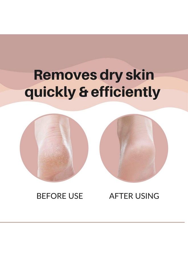 Professional Stainless Steel Lazer Foot Scraperfiler For Hard N Dead Skin Callus Removal Pedicure Foot Scrubber Men N Women