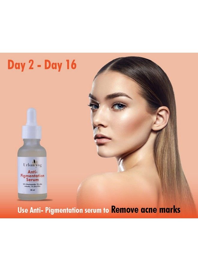 Face Care Combo Kit Antipigmentation Serum (30 Ml) And Acne Pimple Patch (72 Dots) For And Clear Skin With 100% Hydrocolloid 10% Niacinamide; For Acne And Dark Spots; For All Skin Types