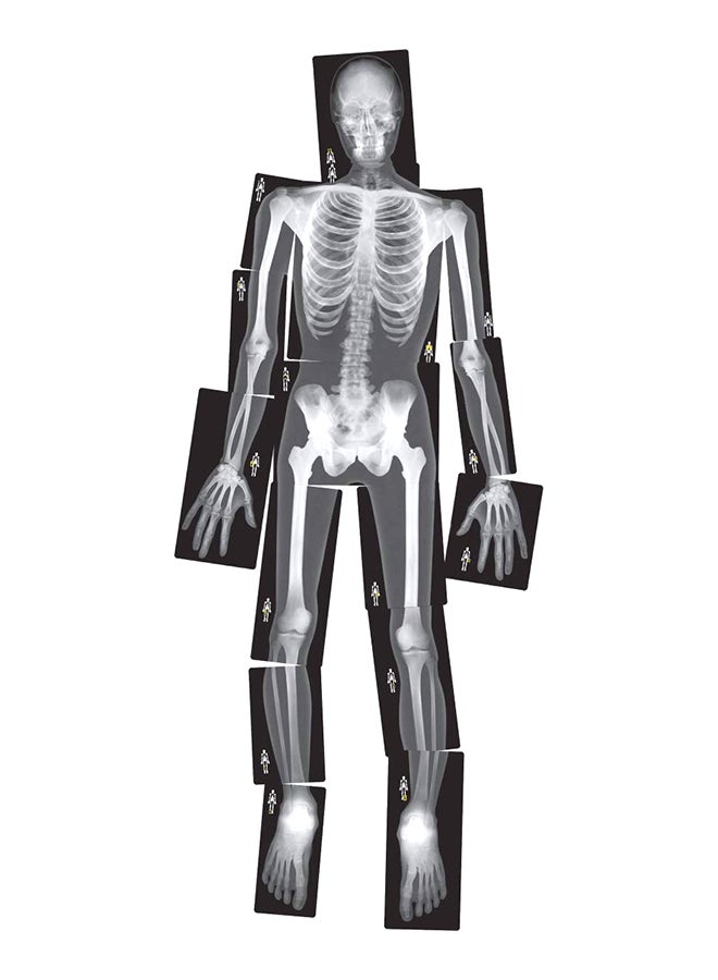 True To Life Human X-Rays 18.1x11.4x0.1inch