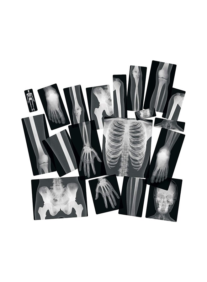 True To Life Human X-Rays 18.1x11.4x0.1inch