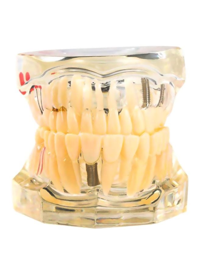 Pathologic Tooth Anatomy Model Toy