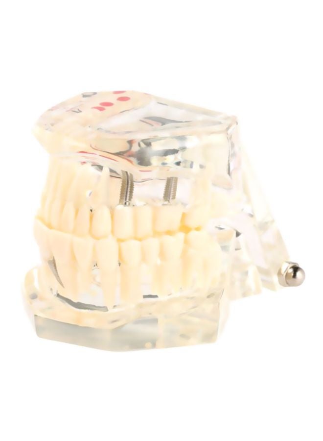 Pathologic Tooth Anatomy Model Toy