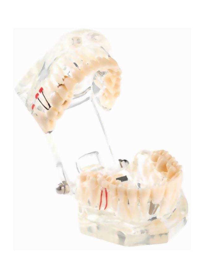 Pathologic Tooth Anatomy Model Toy