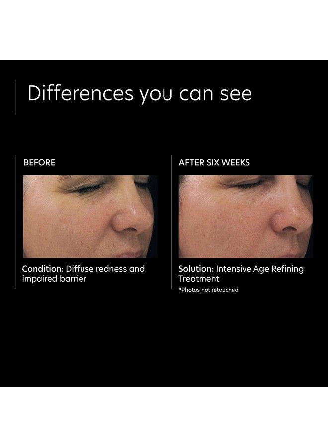 Intensive Anti Aging Face Serum 05% Pure Vitamin A Retinol Cream For Uneven Skin Tone Fine Lines & Wrinkles (1 Oz)