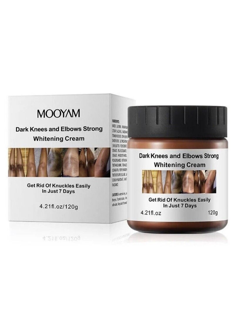 Dark Knees and Elbows Strong Whitening Cream 120g Get Rid of Knuckles Easily in Just 7 Days Skin Whitening Improve Skin Tone Nourishing and Moisturizing Cream