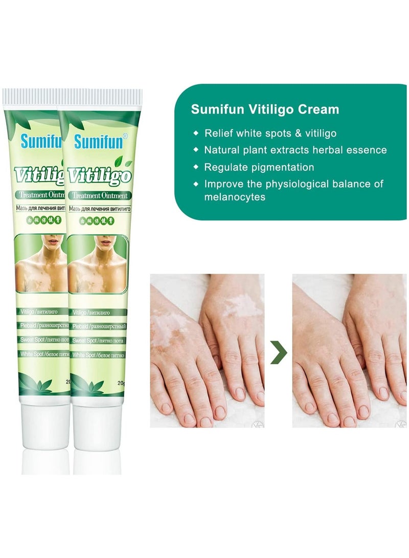 Vitiligo Treatment Ointment Cream for Skin Vitiligo, Psoriasis, Leukoplakia - Reduces White Spots on Skin and Improve Skin Pigmentation 6 Counts