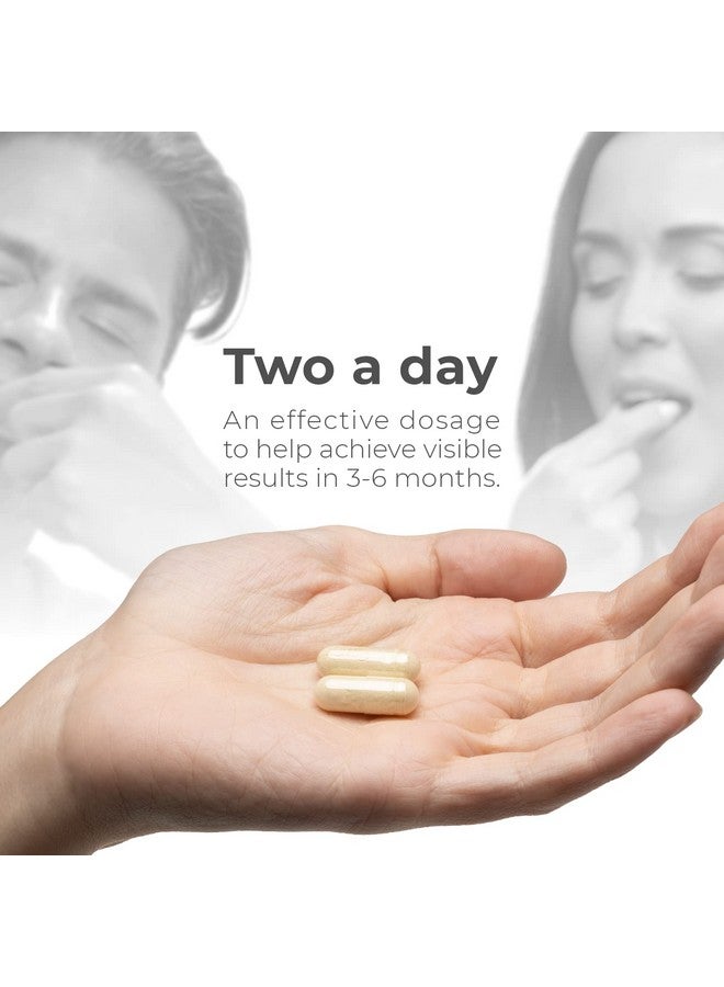 Apillus Nūrish Hair Growth Supplement Get Thicker Fuller Hair With Biotin And Keratin Contains Cynatine Hns For Stronger And Healthier Hair Daily Supplement 60 Count