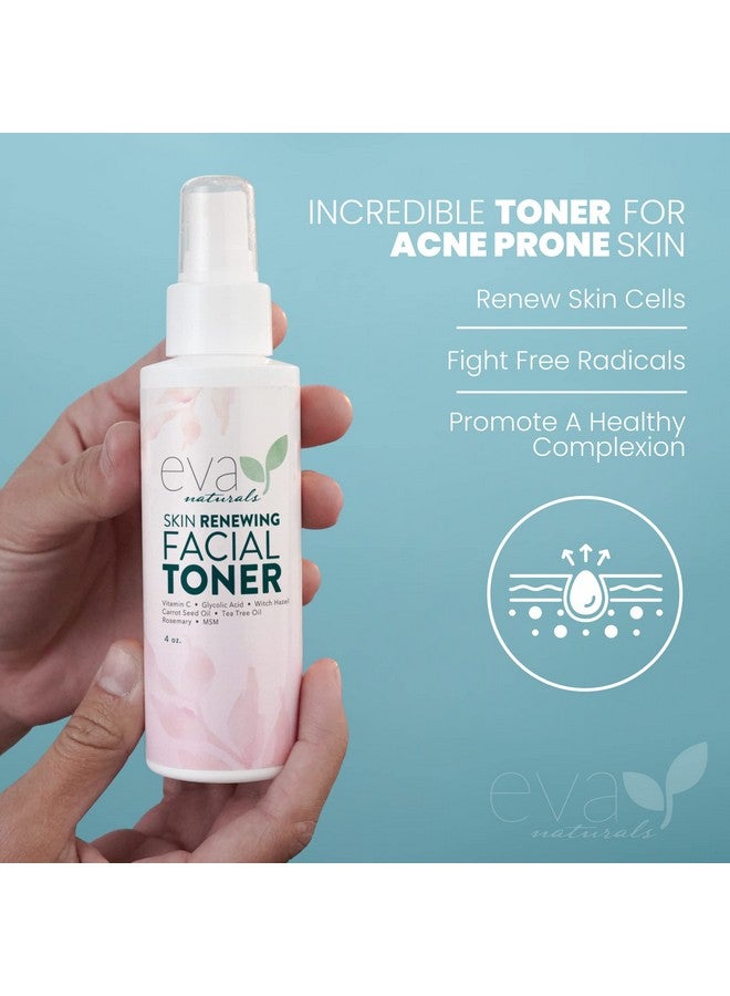 Witch Hazel Toner For Face Facial Toner For Dry Skin Skin Toner For Women Toner For Acne Prone Skin Face Toner For Oily Skin All Skin Types Hydrating Toner For Face And Sensitive Skin (4Oz)