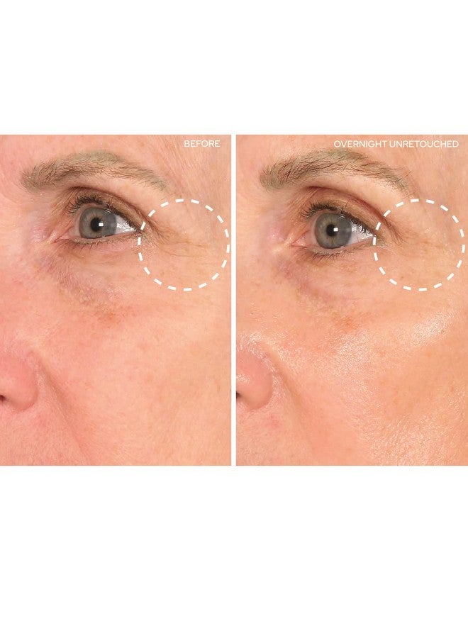 Io Beauty Superlift Forehead Eye & Lip Antiwrinkle Silicone Patches Reduce Brow Smile And Under Eye Wrinkles Overnight
