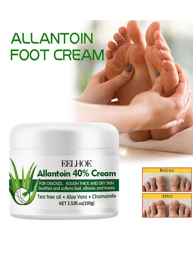Foot Care Cream Allantoin 40% Cream For Cracked,Rough Thick and Dry Skin Soothes and Softens Feet,Elbows and Knees Hydrating and Moisturizing Foot Care Cream