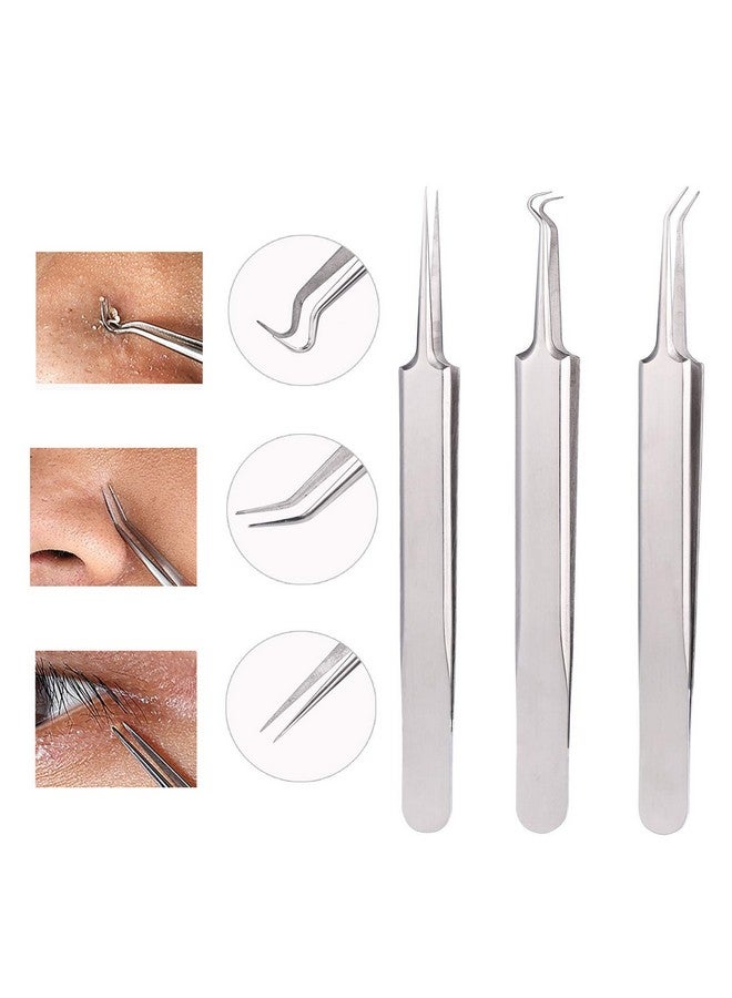 Blackhead Remover Comedone Extractor 3 In 1 Professional Stainless Skin Zit Acne Blemish Whitehead Popping Removing Surgical Tools Set Silver