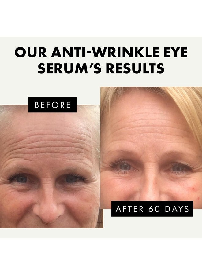 ??? ????* Eye Serum Under Eye Cream For Dark Circles And Puffiness Anti Aging Eye Cream Under Eye Brightener Eye Bags Eye Treatment Caffeine Eye Cream Puffy Eyes Treatment Dark Circle