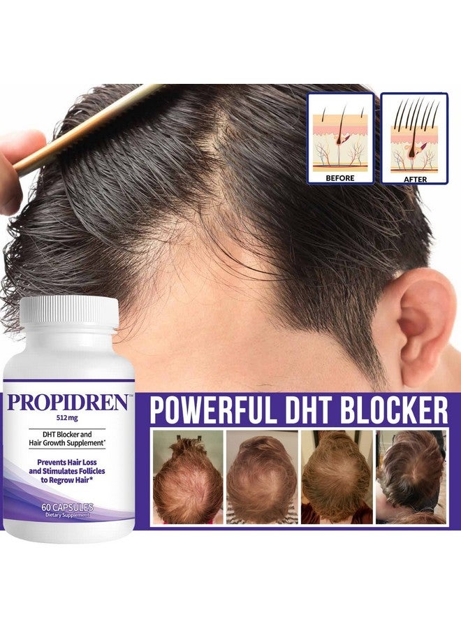 Propidren By Hairgenics Dht Blocker & Hair Growth Capsules To Prevent Hair Loss & Stimulate Hair Follicles To Stop Hair Loss & Regrow Hair. Proprietary Antihair Loss & Hair Regrowth Treatment.