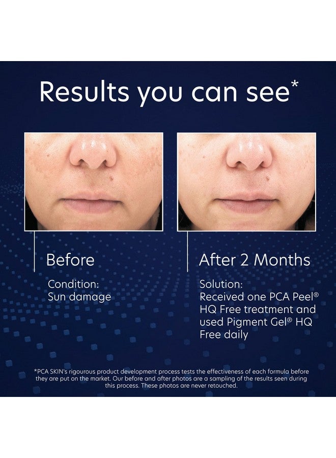Hydroquinonefree Pigment Gel Dark Spot Corrector Dark Spot Serum For Brightening Dark Spots And Hyperpigmentation Helps Even Skin Tone And Promote A Clear Complexion 1.0 Oz Pump