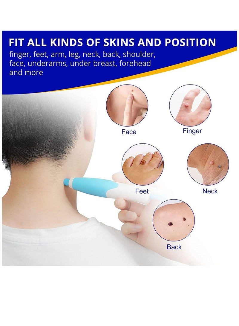 2 in 1 Skin Tag Remover Auto Skin Tag Removal Pen with 40 Micro and Regular Skin Tag Strips for Safe and Removal of Small Skin Tags