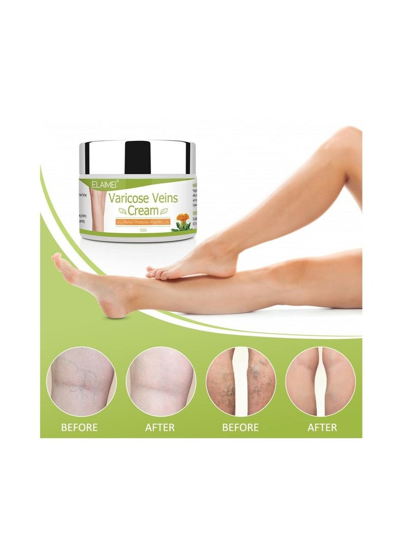 2 Pieces Vein Healing Varicose Veins Treatment Cream [50g Each] Vein Healing Skin Treatment For Legs Hands & Any Body Parts Improve Blood Circulation Cream With Natural Herbal Ingredients