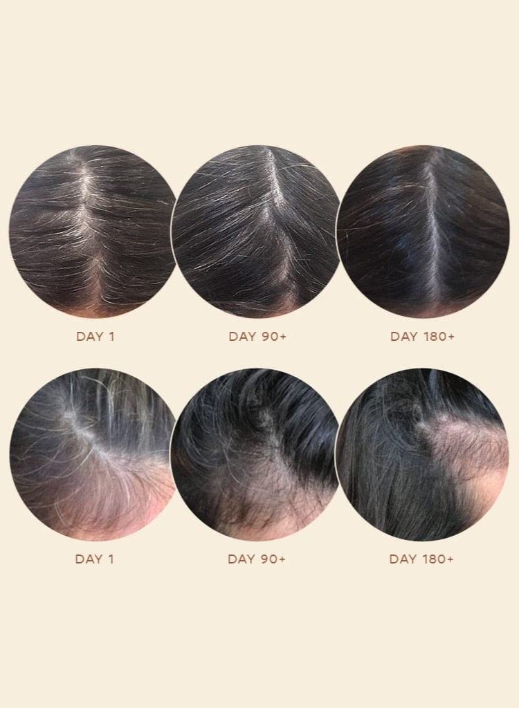 VEGAMOUR GRO Ageless Anti-Gray Hair Serum, 30ml – Promotes Natural Pigment Retention, Reduces Gray Hair, and Supports Healthy, Vibrant Hair Growth with Plant-Based Ingredients