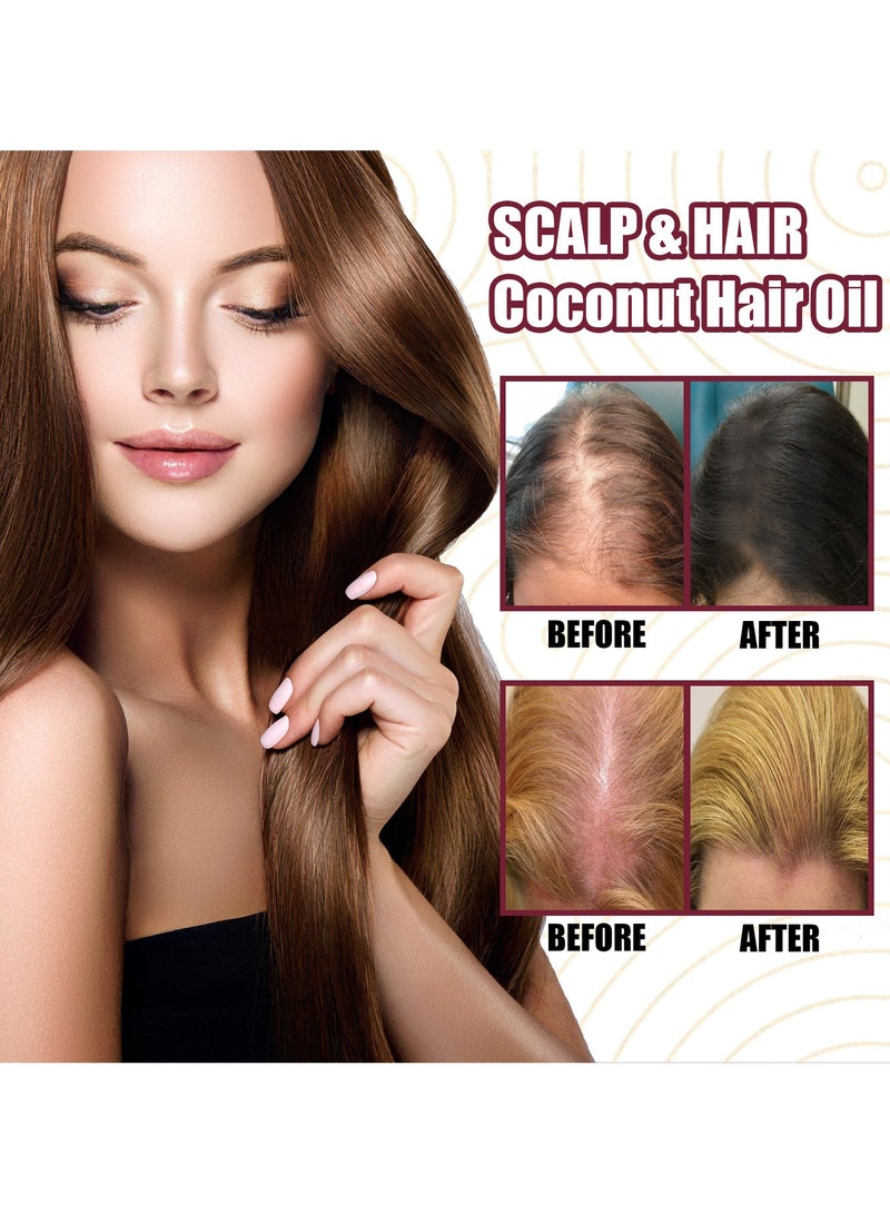 Onion Hair Thickness Essential Oil Moisturizes Thick Hair Thickness Hair Care Strengthening Hair Growth Spray