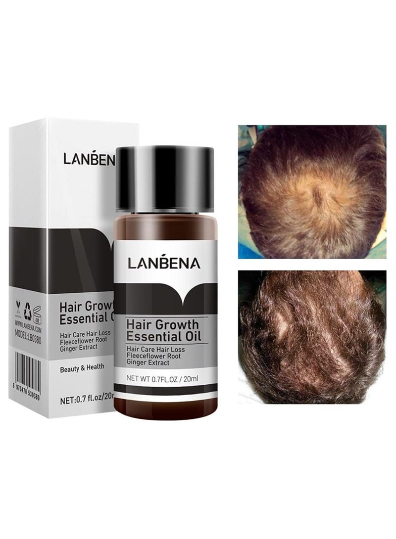 Hair Growth Essence Fast Powerful Hair Care Essential Oil Treatment Preventing Hair Loss 20ml 2 Pack