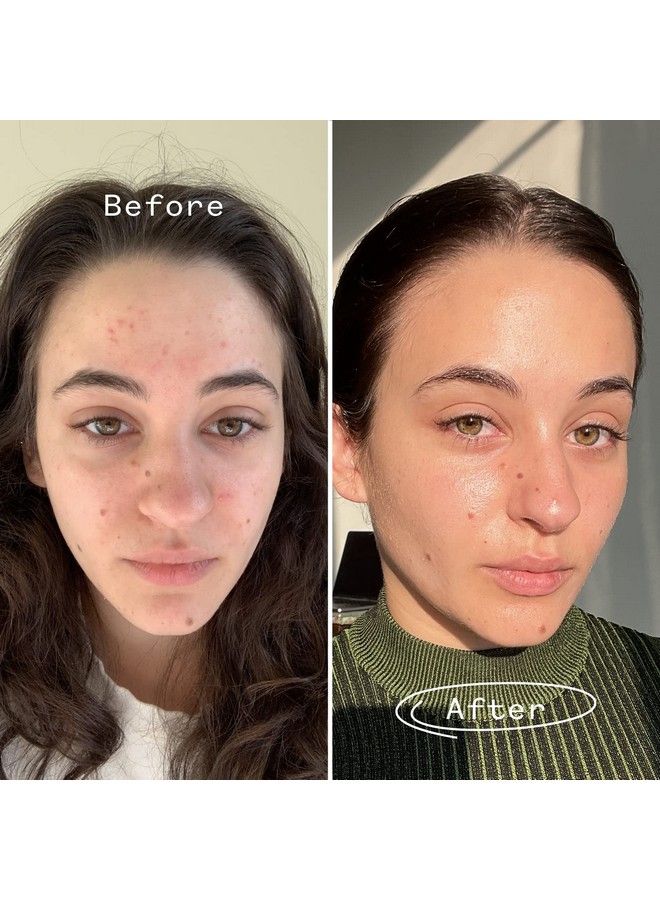 Organic Carbon Star Detoxifying Overnight Face Oil | Natural Vegan Sensitive Skincare (1 Fl Oz | 30 Ml)