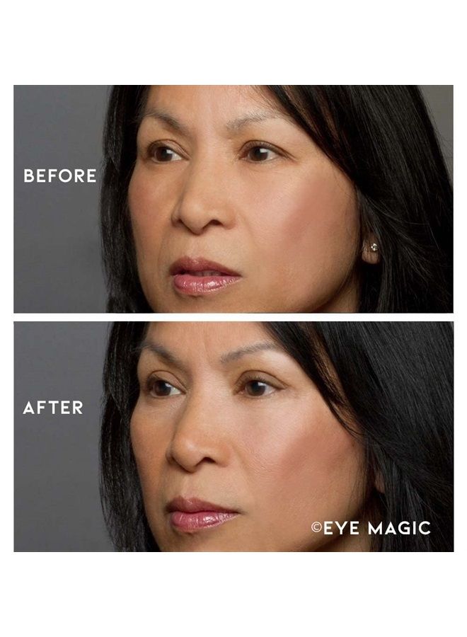 Premium Instant Eye Lift (Small/Med Kit + Emollient Gel) Lifts and Defines Droopy, Sagging, Hooded, Eyelids For A Youthful Look | Safe For Daily Use | Made in America