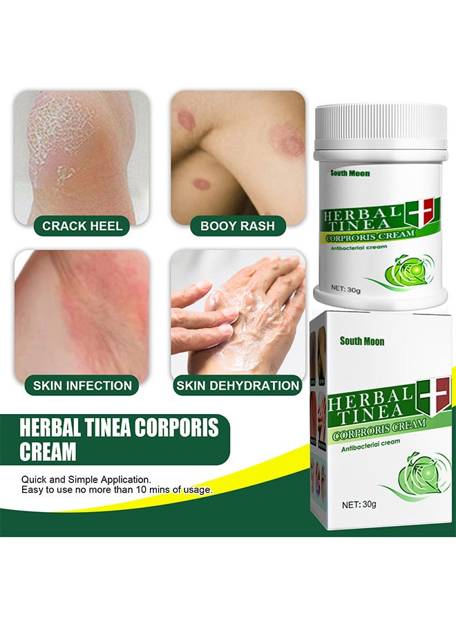 Herbal Tinea Corproris Cream - High Quality Itchy Skin Relief Antipruritic Dermatophyte Ointment 30G Nursing Topical Ointment