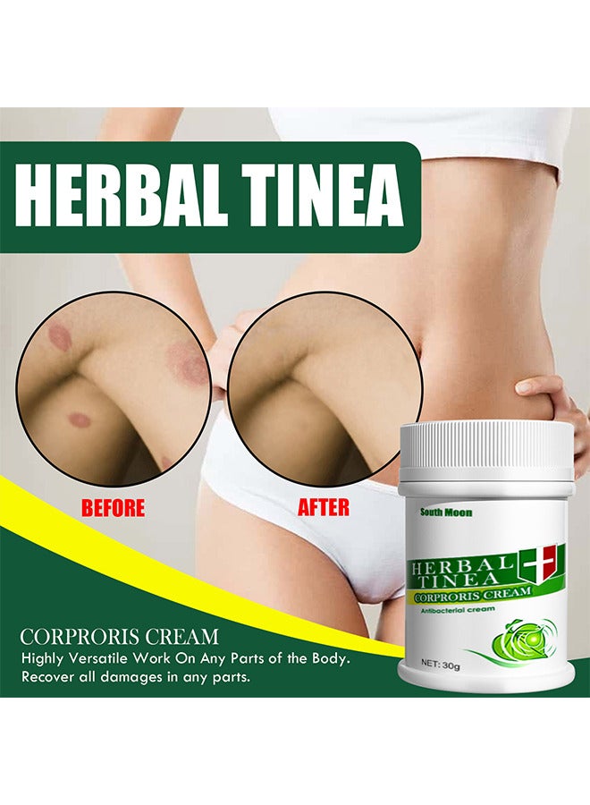 Herbal Tinea Corproris Cream - High Quality Itchy Skin Relief Antipruritic Dermatophyte Ointment 30G Nursing Topical Ointment