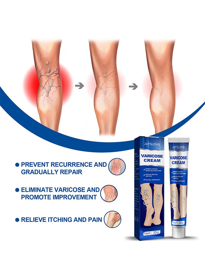 Varicose Veins Cream, Relief Phlebitis Angiitis 100% Natural Ingredients Added Eliminate The Appearance Of Varicose Veins - Vein Inflammation Treatment For Men And Women 20G