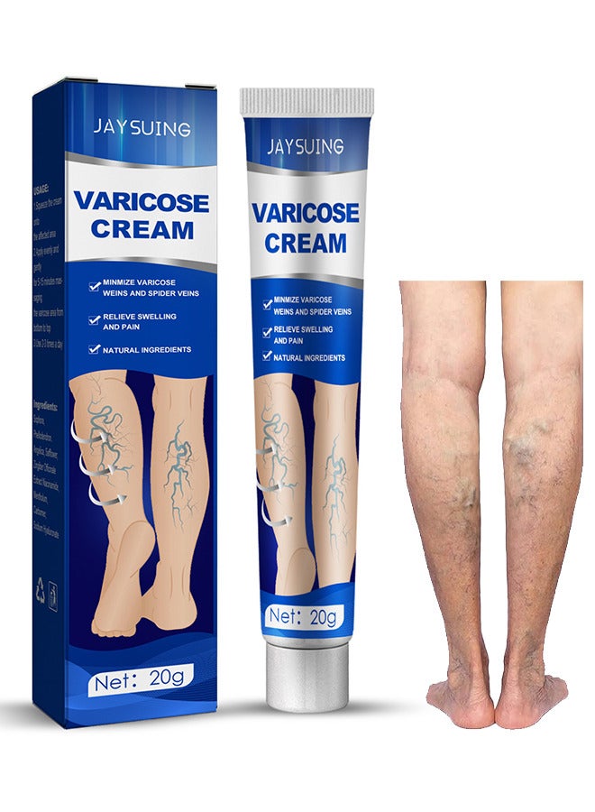 Varicose Veins Cream, Relief Phlebitis Angiitis 100% Natural Ingredients Added Eliminate The Appearance Of Varicose Veins - Vein Inflammation Treatment For Men And Women 20G