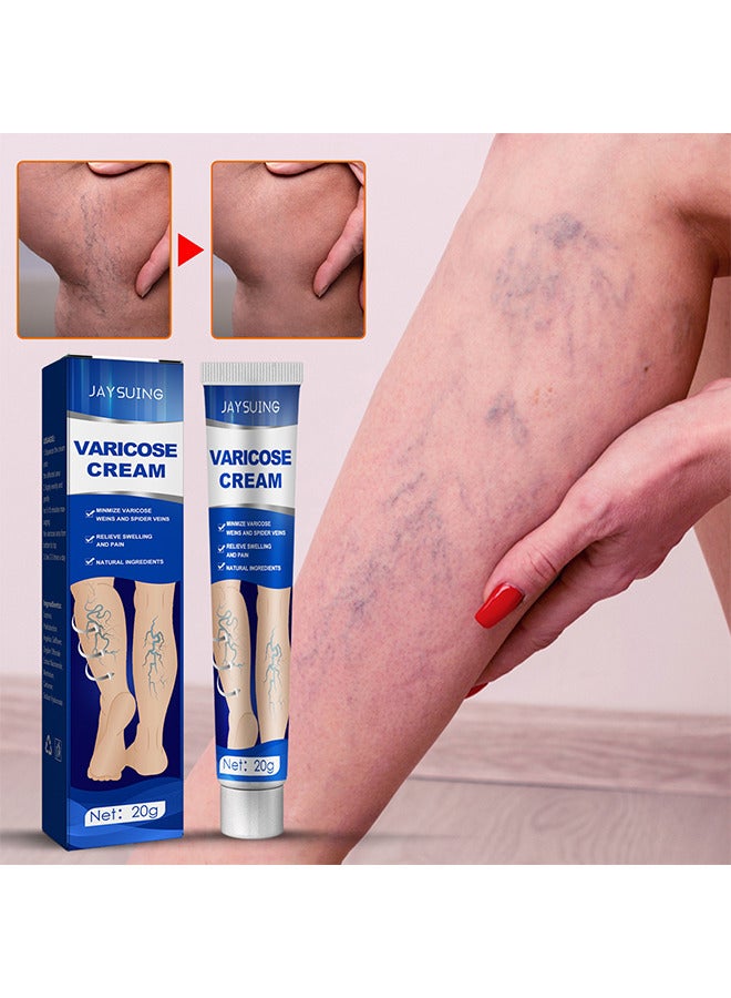 Varicose Veins Cream, Relief Phlebitis Angiitis 100% Natural Ingredients Added Eliminate The Appearance Of Varicose Veins - Vein Inflammation Treatment For Men And Women 20G
