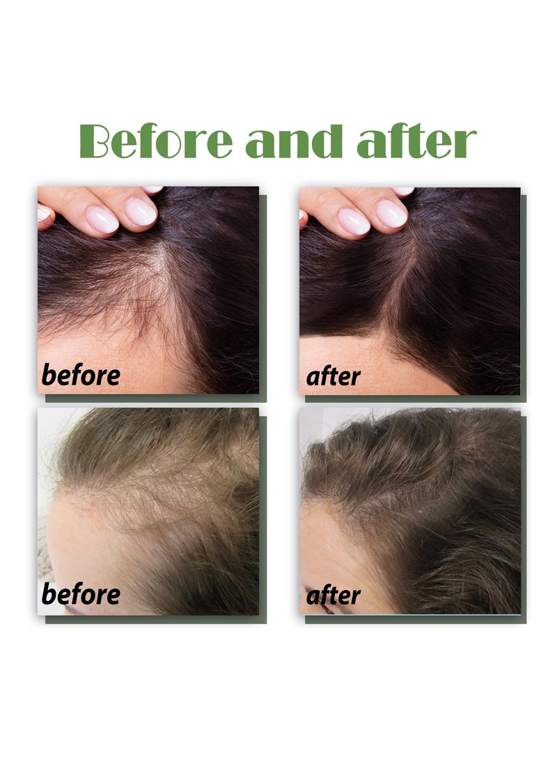 Thick Hair Spray Anti Hair Loss Firming Hair Care Strong Hair Repair Root Hair Care Spray
