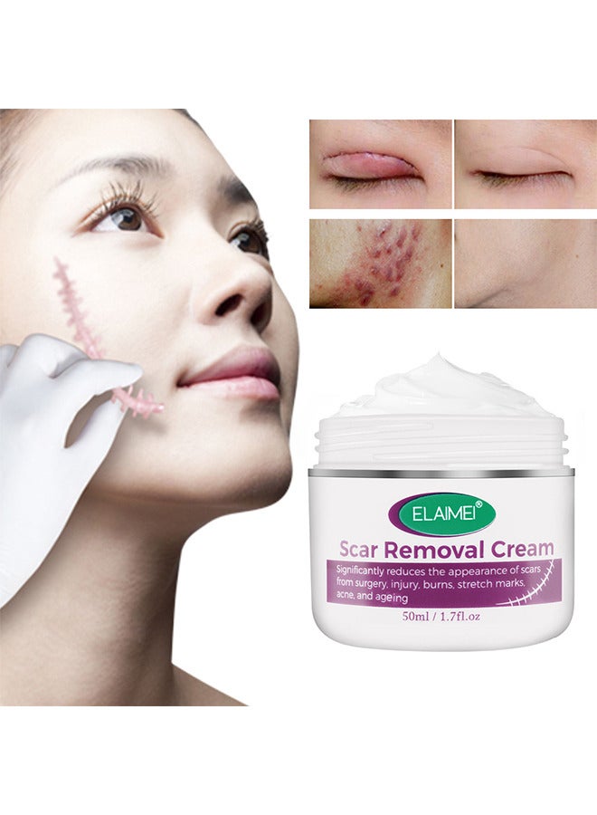 Scar Removal Cream, Advanced Scar Gel For Surgical And Acne Scars, Cuts, Burns, Helps With Old And New Scars, Natural Scar Treatment For Face And Body 50ML