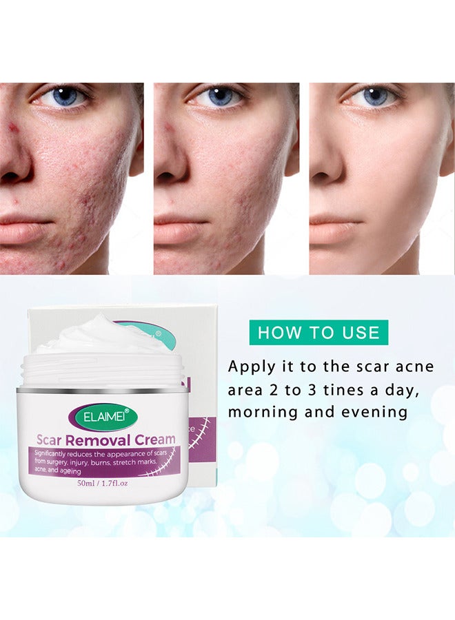 Scar Removal Cream, Advanced Scar Gel For Surgical And Acne Scars, Cuts, Burns, Helps With Old And New Scars, Natural Scar Treatment For Face And Body 50ML