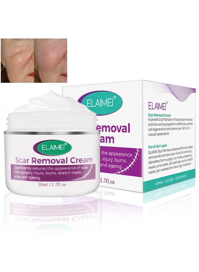 Scar Removal Cream, Advanced Scar Gel For Surgical And Acne Scars, Cuts, Burns, Helps With Old And New Scars, Natural Scar Treatment For Face And Body 50ML