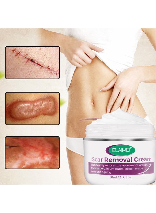 Scar Removal Cream, Advanced Scar Gel For Surgical And Acne Scars, Cuts, Burns, Helps With Old And New Scars, Natural Scar Treatment For Face And Body 50ML
