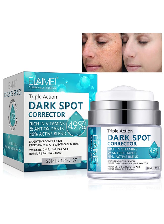 Dark Spot Corrector For Face And Body, Dark Spot Corrector Cream, Melasma Treatment, Hyperpigmentation Treatment, Freckle Remover With Tranexamic Acid, Niacinamide, Squalane And Vitamin E Serum