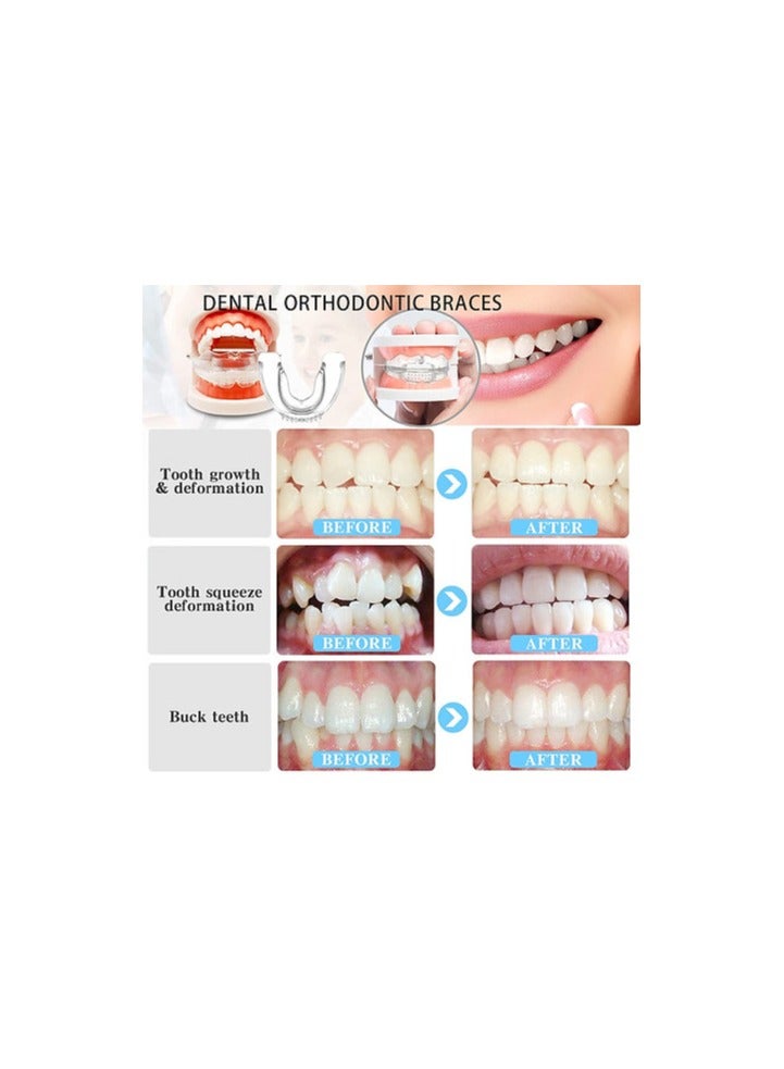 Multifunctional Invisible Silicone Teeth Braces. Three Phases, Custom Food Grade, Medical Material, Dental Aligner.