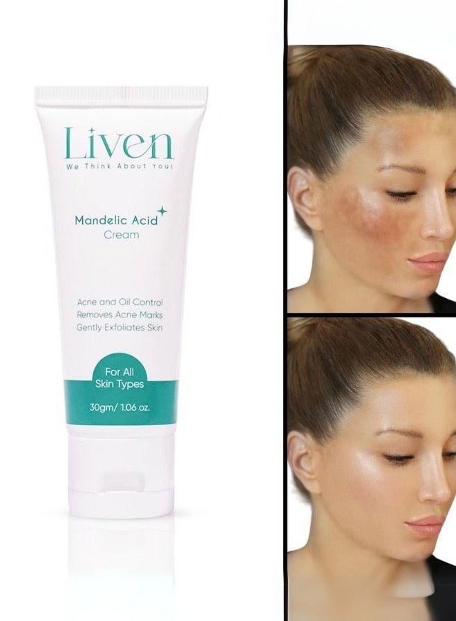 Liven Mandelic Acid Cream Acne and Oil Control Removes Acne Marks Gently Exfoliates Skin For All Skin Types