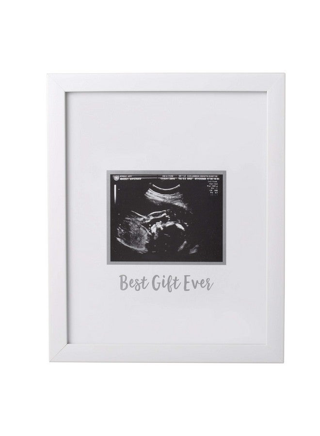 Sonogram Signature Frame Guest Book Ultrasound Picture Keepsake Gender Neutral Baby Shower Party Decor Gift For Expecting Moms Alternative Guest Book White With Included Marker